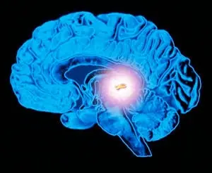 pineal gland